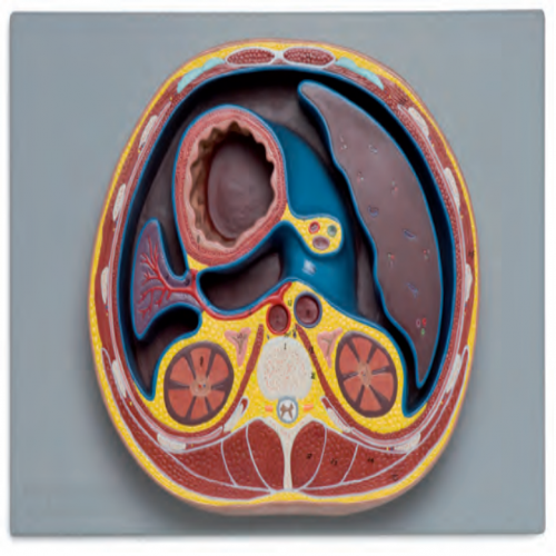  腹腔橫斷模型